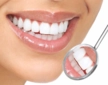 Diş Temizleme Yöntemleri